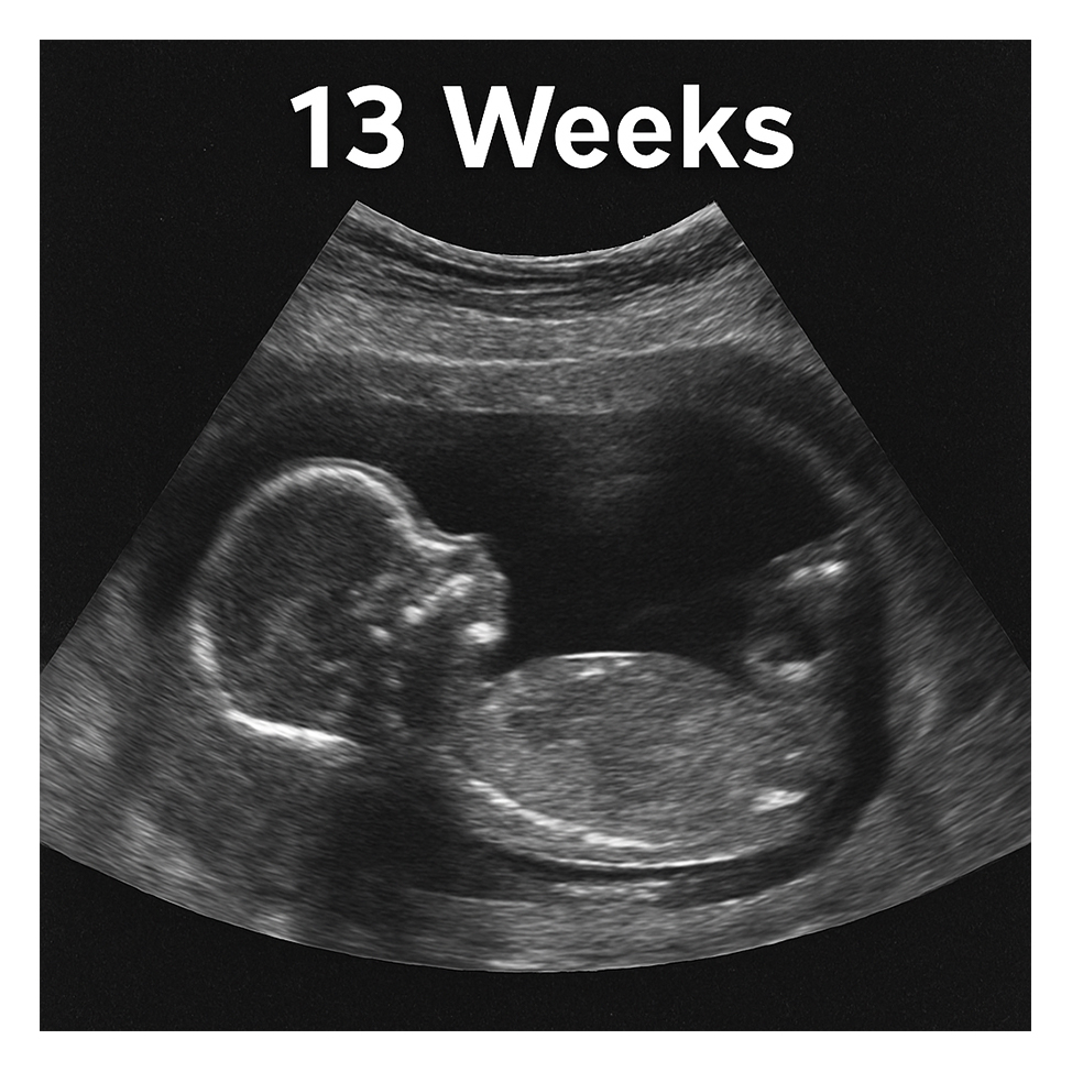 13 Weeks Pregnant Ultrasound: What You Might See